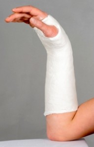 Traditional plaster cast