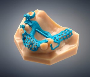 3d printed denture mold