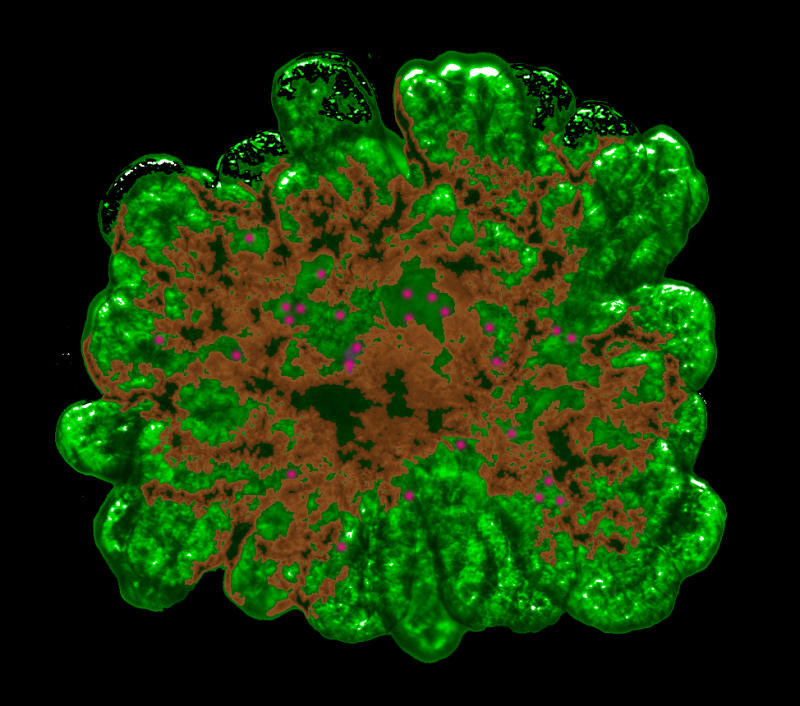 Tiny pancreas created using 3d printing