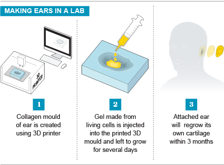 How 3D printed ears are created